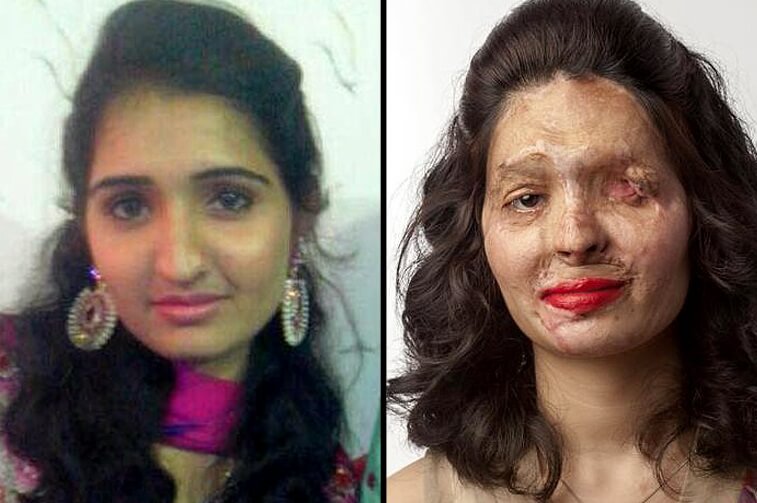 Fight Against Acid Attack